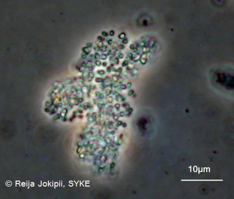 Kestvity Lugolin liuoksella